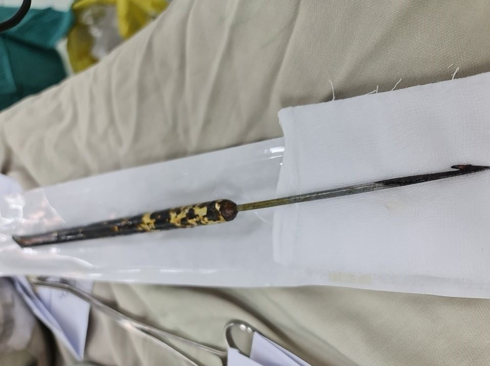 Nguoi dan ong bi thung noi tang do dung sung ban chuot hinh anh