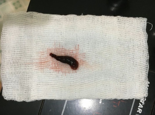 Vat trong hoc mui anh 1