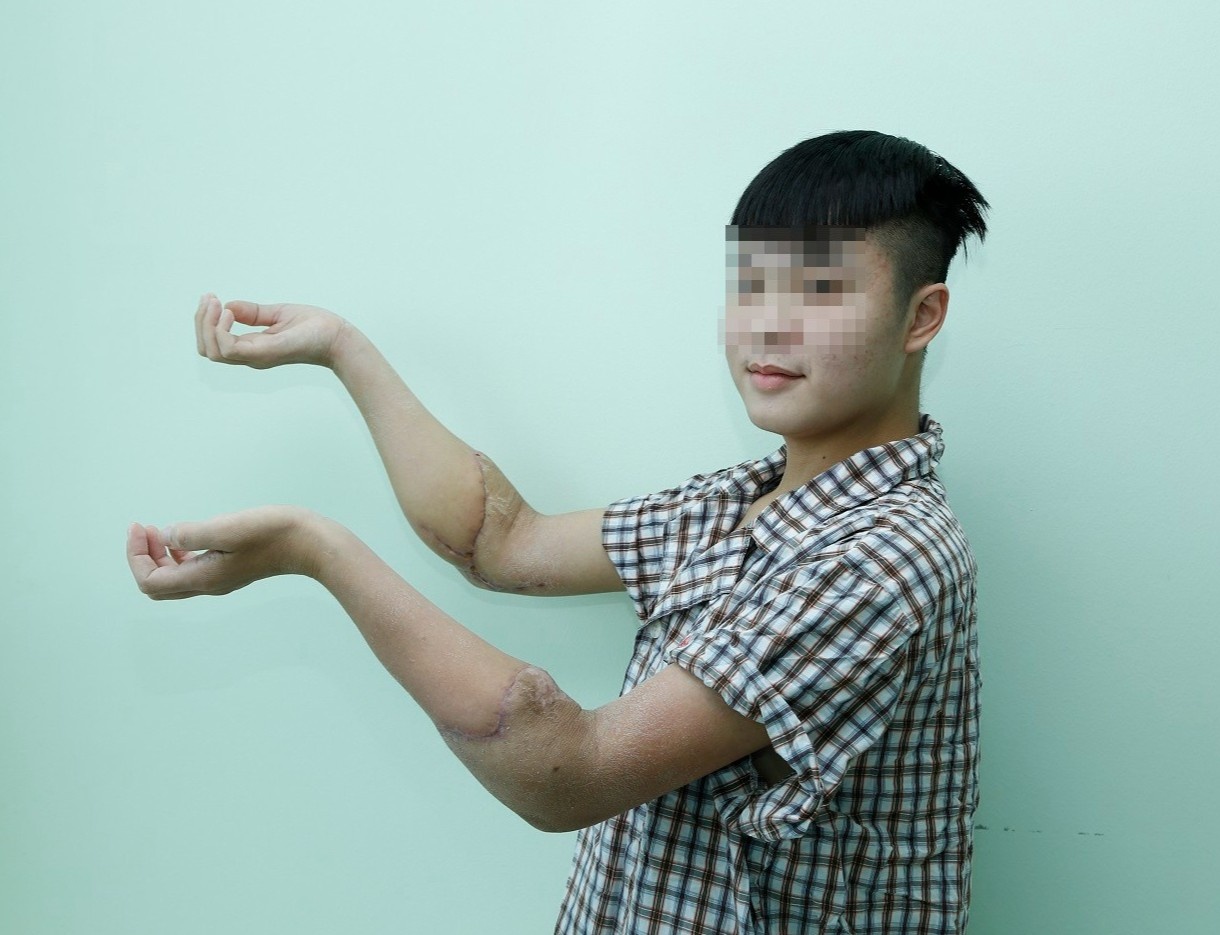 Mot nguoi chet nao hien tang cuu 6 benh nhan hinh anh