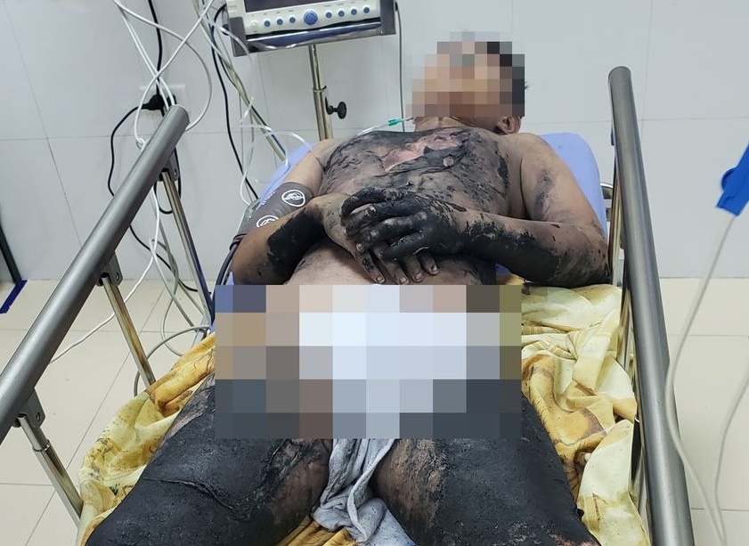 Bong nang vi tu lam thi nghiem tai nha anh 1