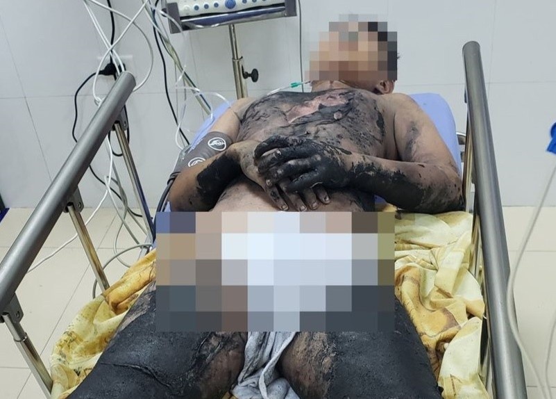 Be trai bong nang do tu lam thi nghiem tai nha hinh anh