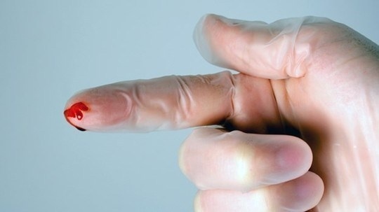 phoi nhiem HIV anh 1