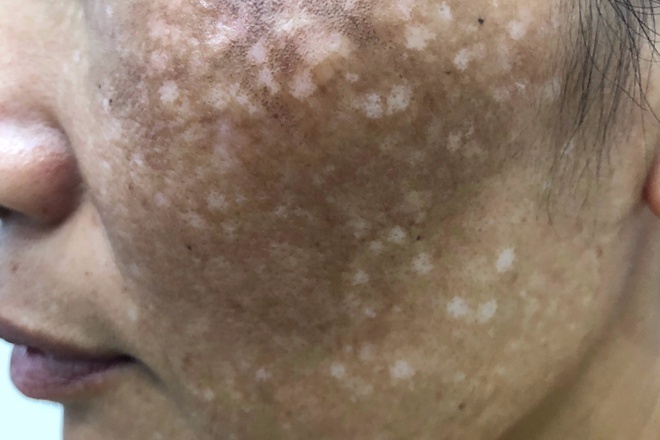 Nguoi phu nu bi tai bien vi tri nam o spa hinh anh