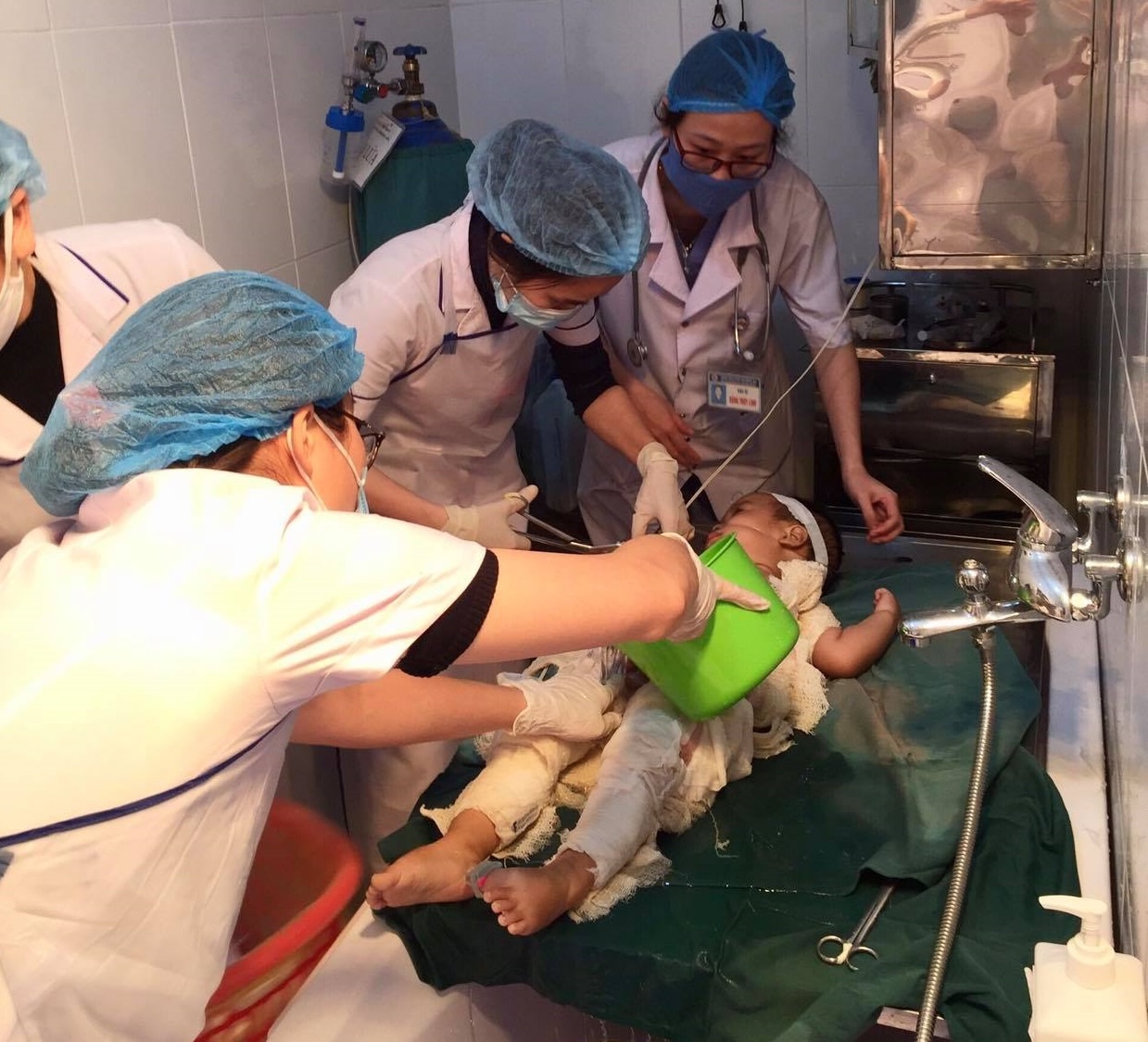 Nnhiem trung vi chua bong bang nuoc nam va ruou anh 1