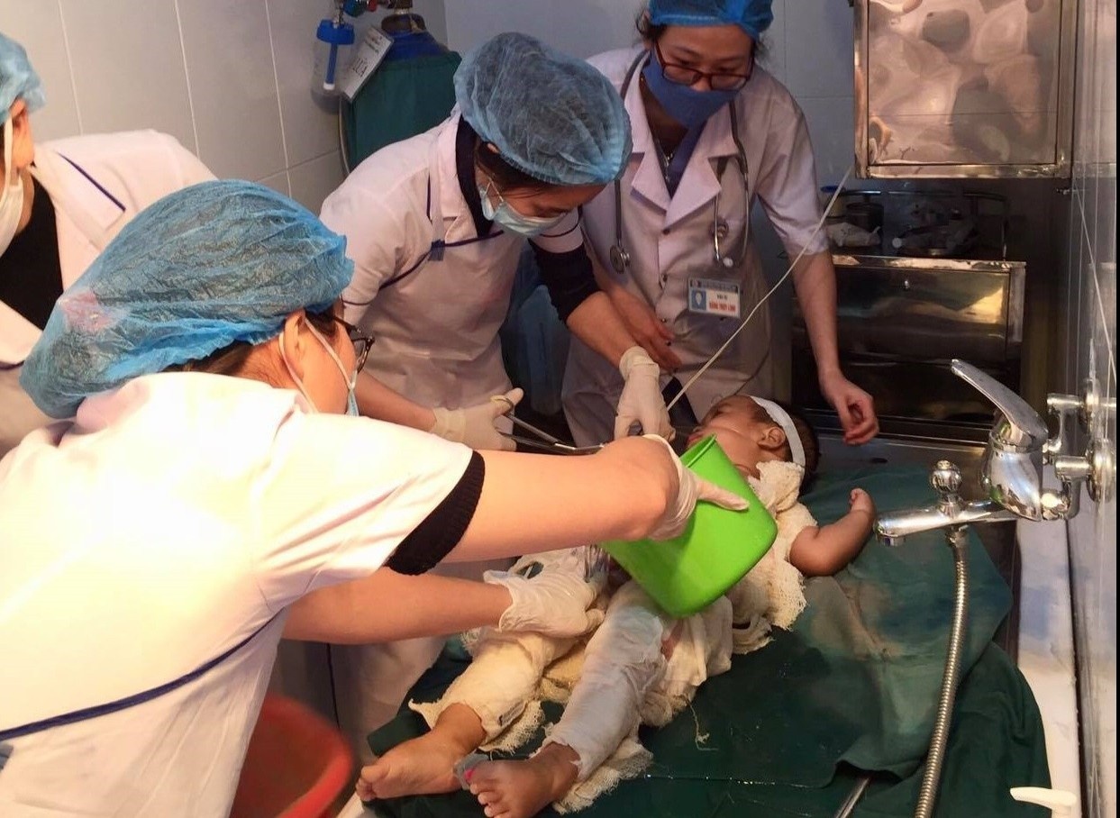 Be trai bi nhiem trung vi duoc chua bong bang nuoc mam va ruou hinh anh