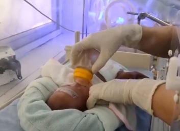 Bé sơ sinh nặng 0, 6 kg ảnh 1 Be so sinh nang 0, 6 kg anh 1