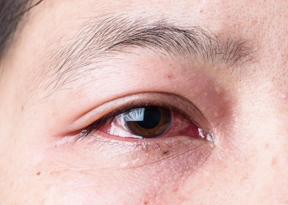 Thu pham khien nguoi phu nu chay nuoc mat suot mot nam hinh anh