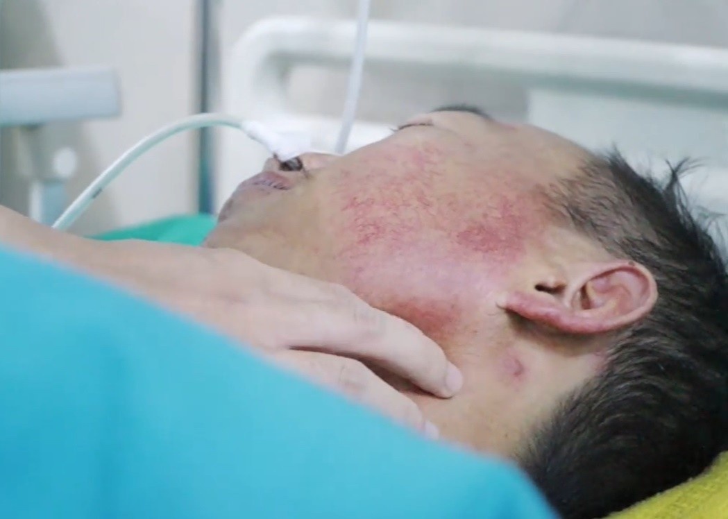 Nguyen nhan khien nguoi dan ong non ra mau tuoi nhieu lan hinh anh