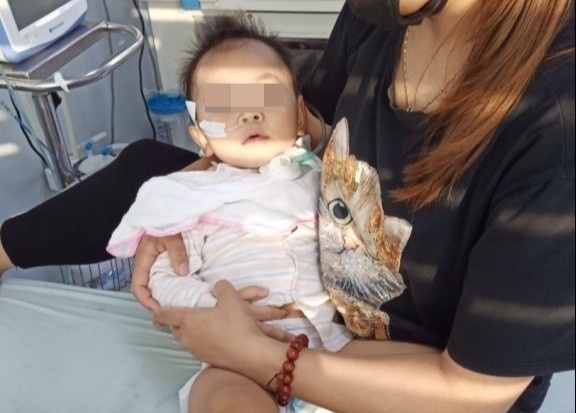 Be gai 19 thang tuoi liet chi vi benh chan tay mieng hinh anh