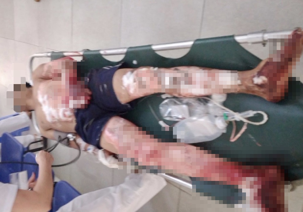 Bong nang do dien giat anh 1