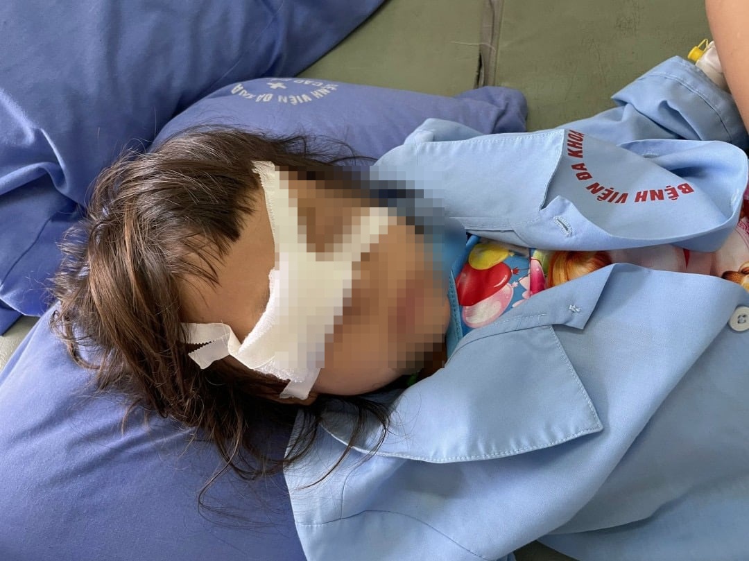 Cay choc vao mat anh 1