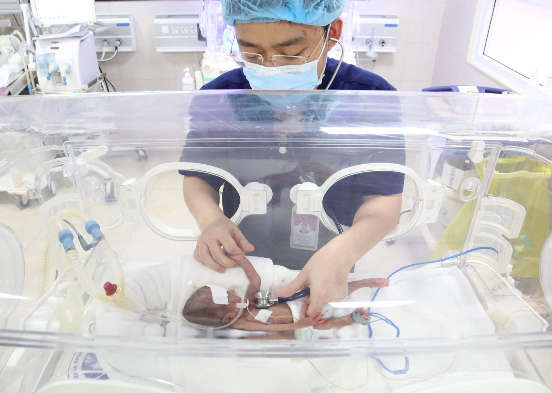 Cuu be sinh non nang 600 g hinh anh