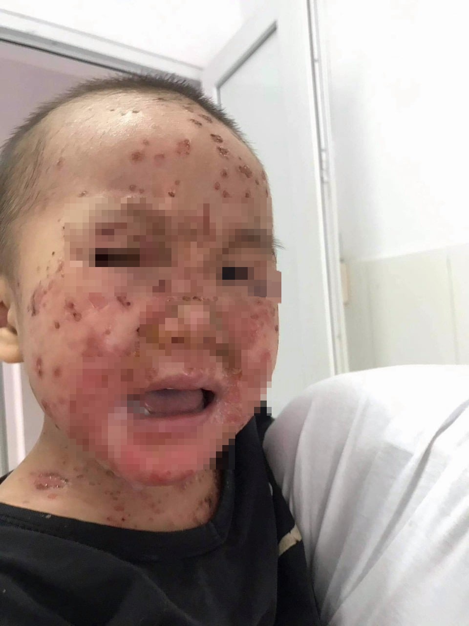 noi mun ngua khap co the anh 1