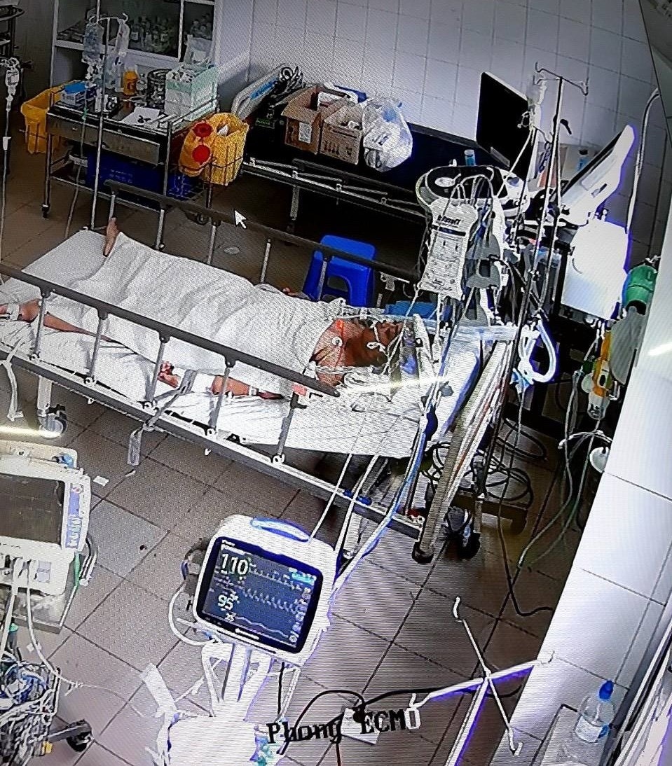 mo bat con cho benh nhan Covid-19 anh 1