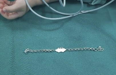 Trẻ nuốt phải dây chuyền ảnh 1 Tre nuot phai day chuyen anh 1