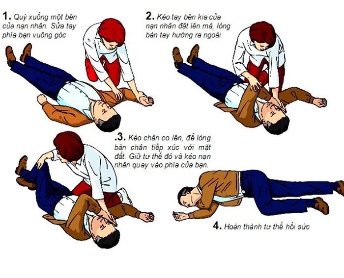 so cuu benh nhan dot quy anh 1