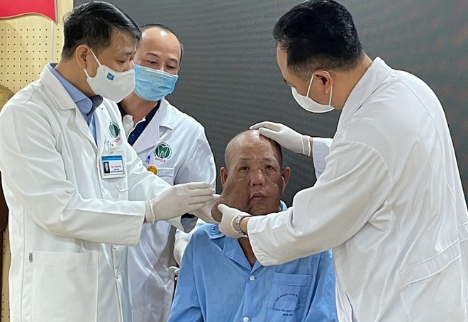 Khoi u lam bien dang khuon mat nguoi dan ong duoc cat bo hinh anh