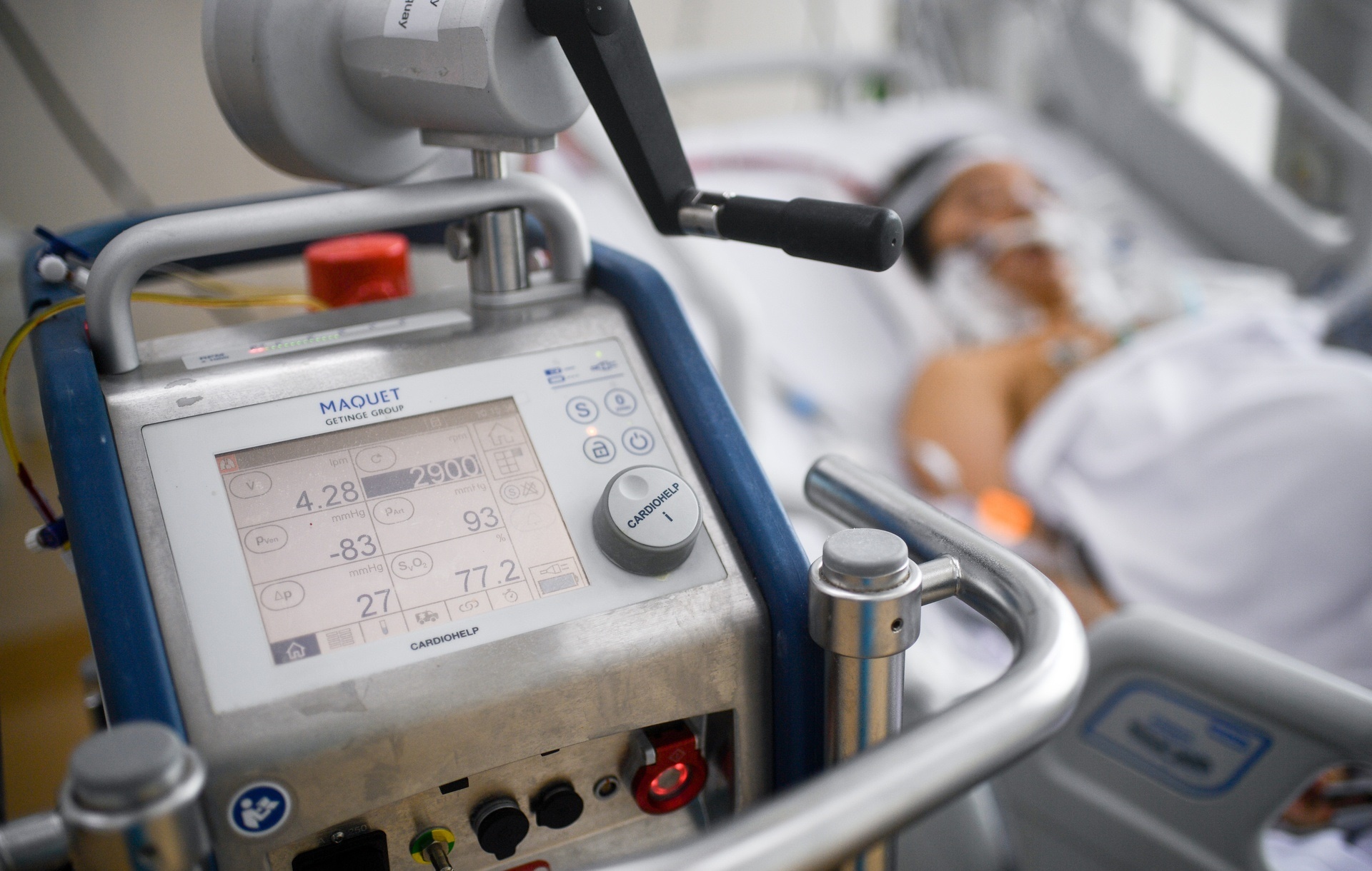 Nguyen nhan nguoi beo de tro nang khi mac Covid-19 hinh anh