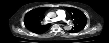 Thuyen tac phoi hau Covid-19 anh 1