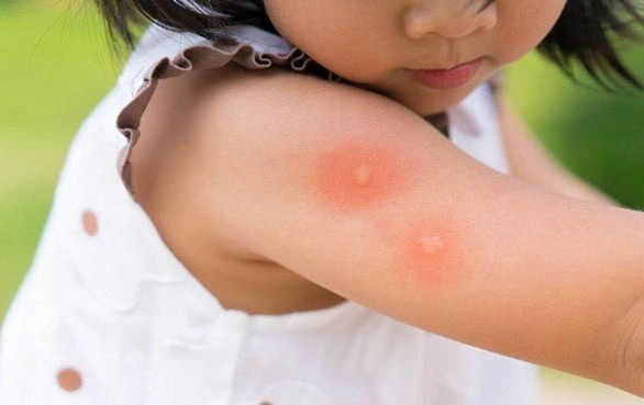 Be gai 7 tuoi hon me gan vi sot xuat huyet hinh anh