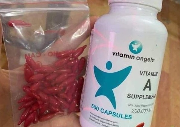 Dieu gi xay ra khi tu y mua vitamin A lieu cao cho tre uong? hinh anh