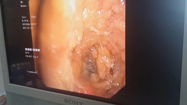 Nhiem nam sau khi an moi anh 1