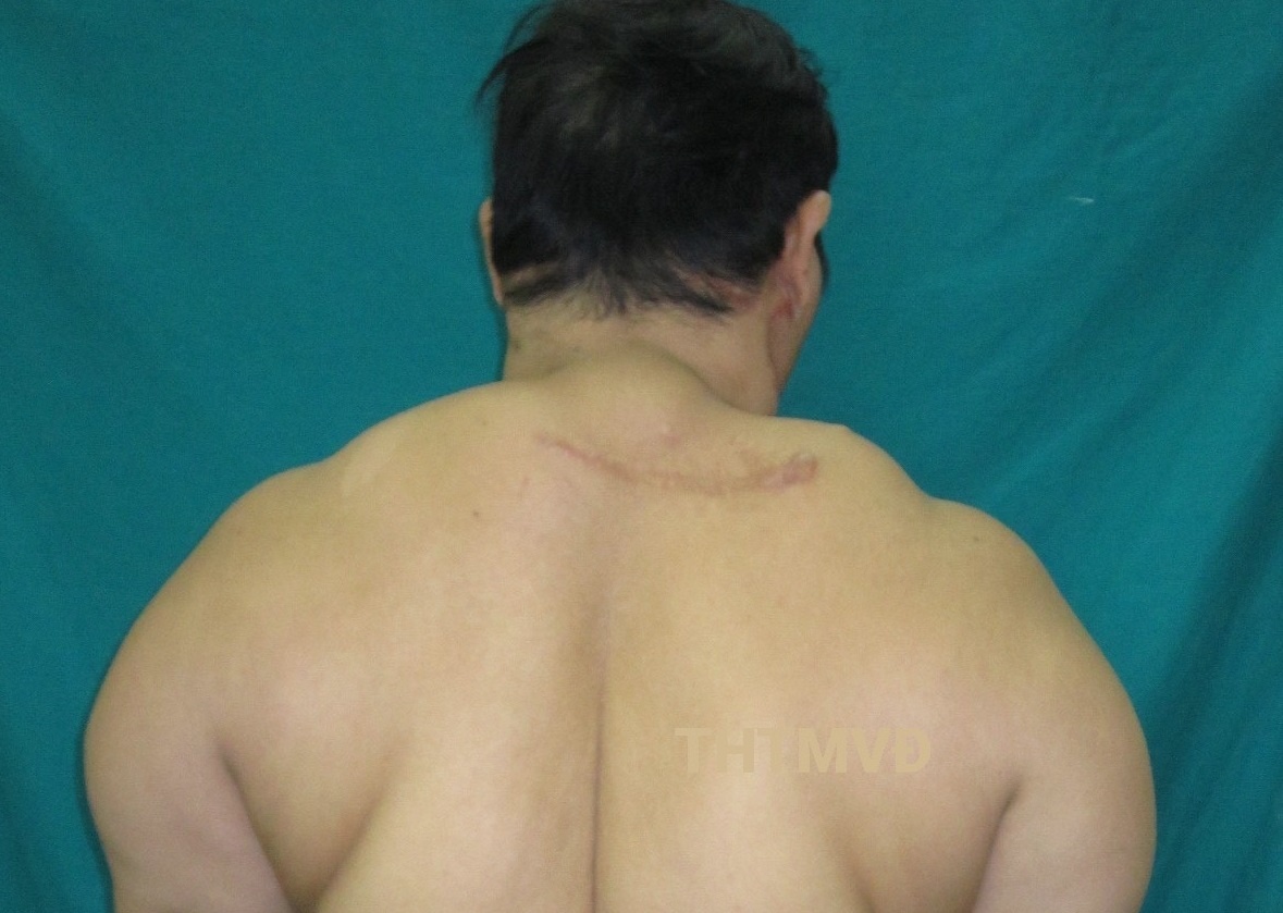 Can benh hiem gap khien nguoi phu nu tang can mat kiem soat hinh anh