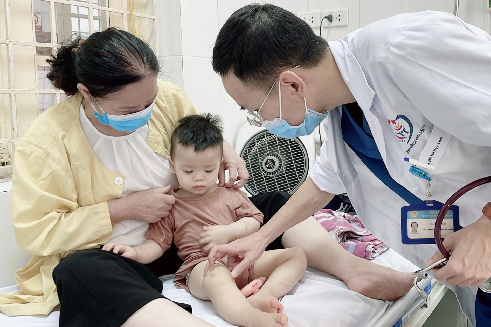 Sot xuat huyet dien bien phuc tap, tre de gap bien chung nang hinh anh