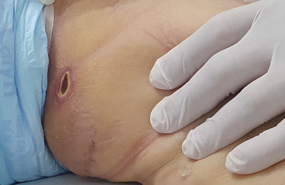 Bien chung nguy hiem cua sot mo anh 2