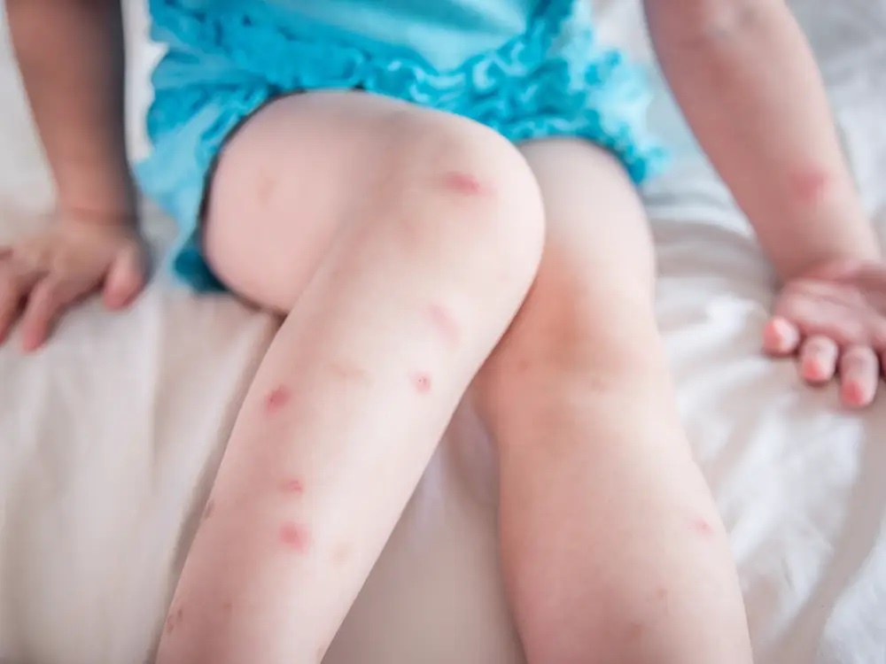 San ngua o tre nho anh 2