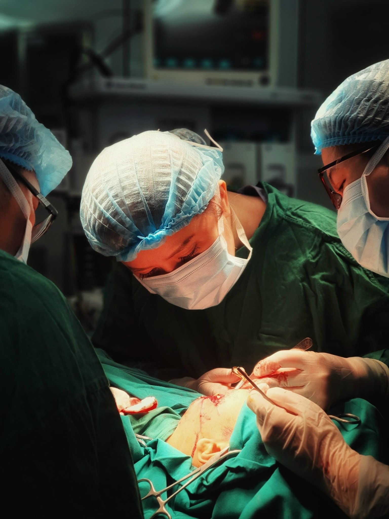 khuyet moi do no phao anh 1