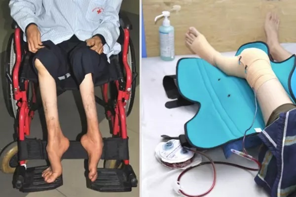 Người được bảo hiểm chi trả hơn 38 tỷ điều trị ảnh 1 Nguoi duoc bao hiem chi tra hon 38 ty dieu tri anh 1
