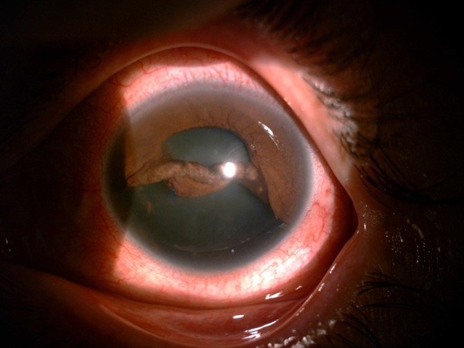 Chan thuong mat anh 1