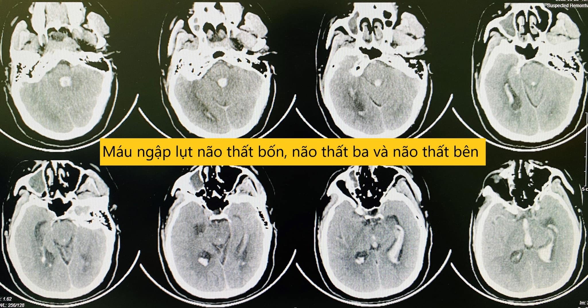 dot quy khi lam viec anh 1