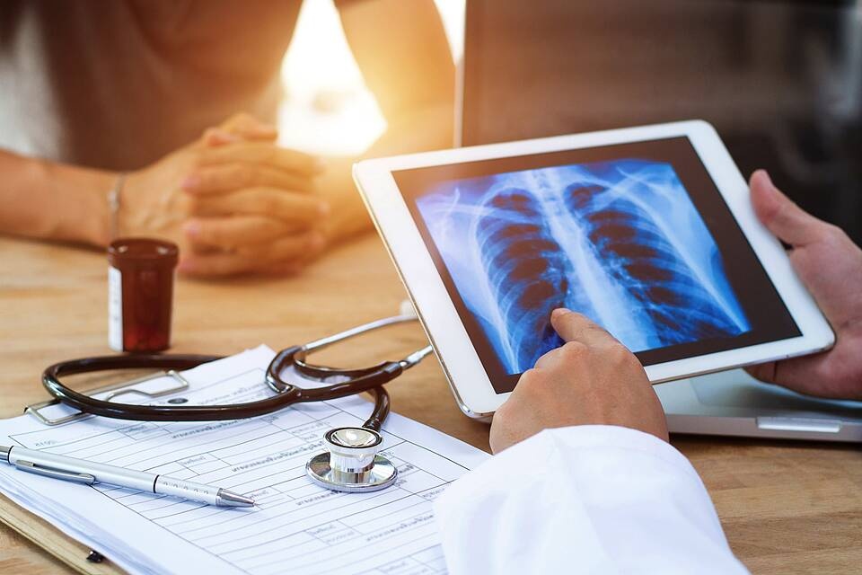 mac ung thu phoi anh 2