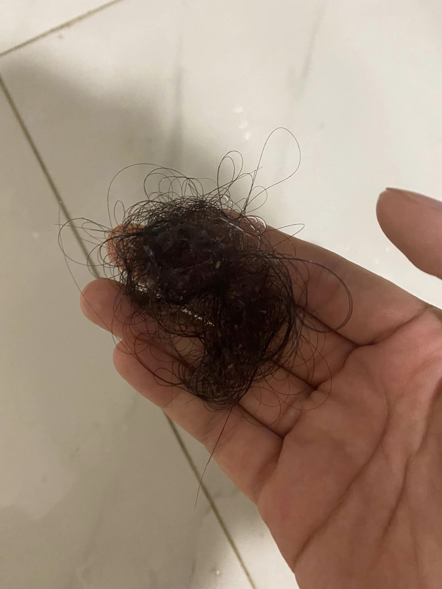 thuoc tri rung toc anh 1