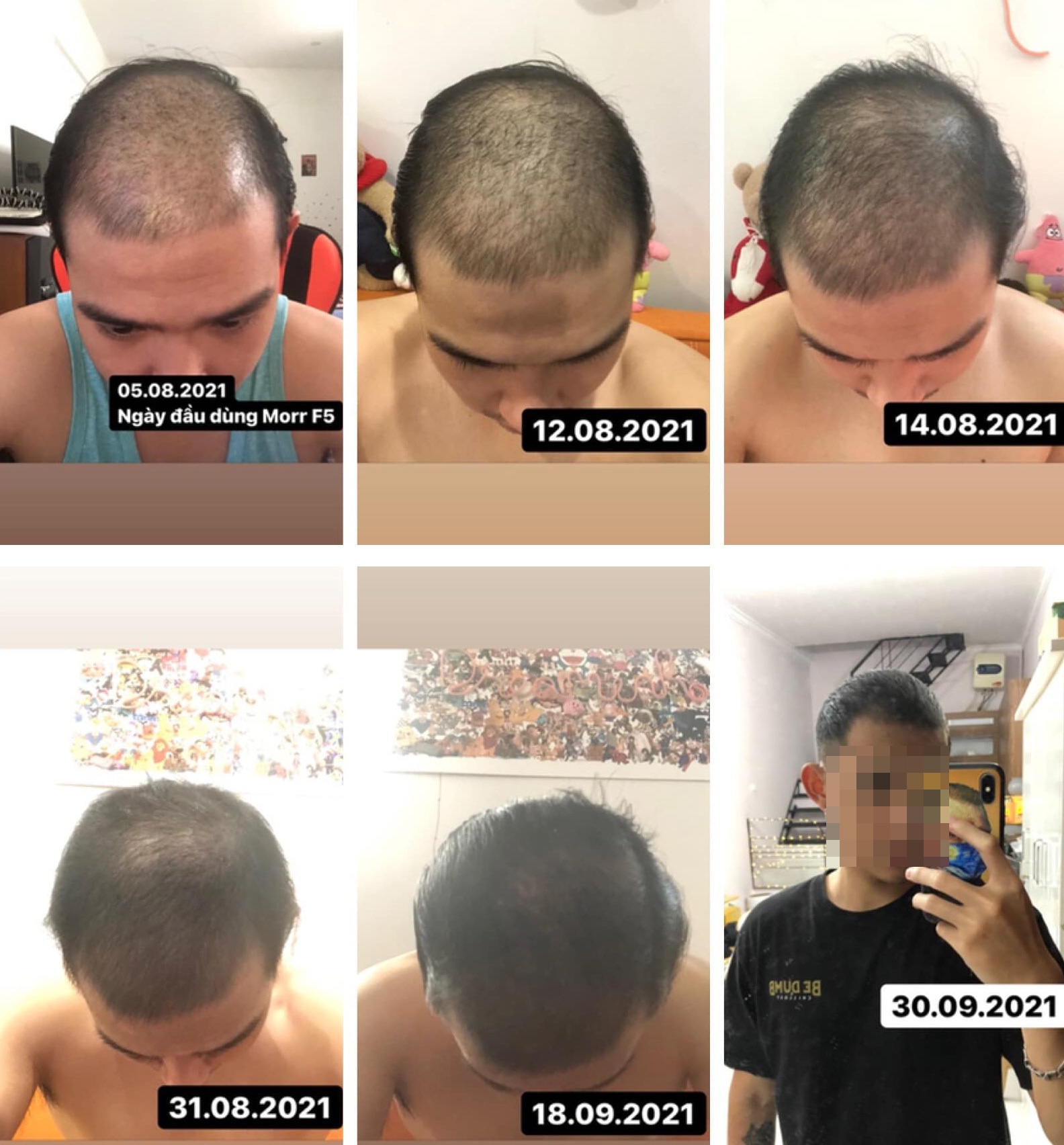 toc rung ca nam anh 1