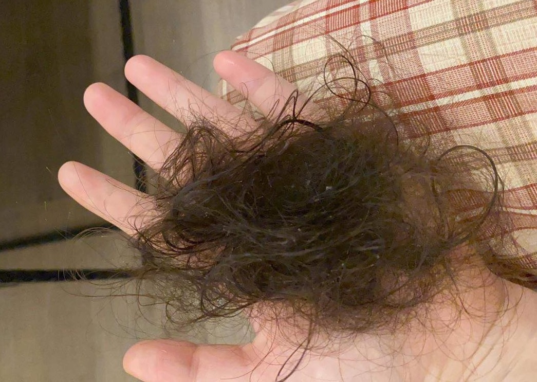 toc rung ca nam anh 2