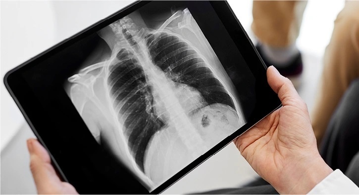 nguy co ung thu phoi anh 1