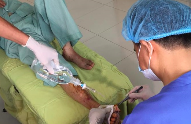 thuốc đái tháo đường ảnh 1 thuoc dai thao duong anh 1