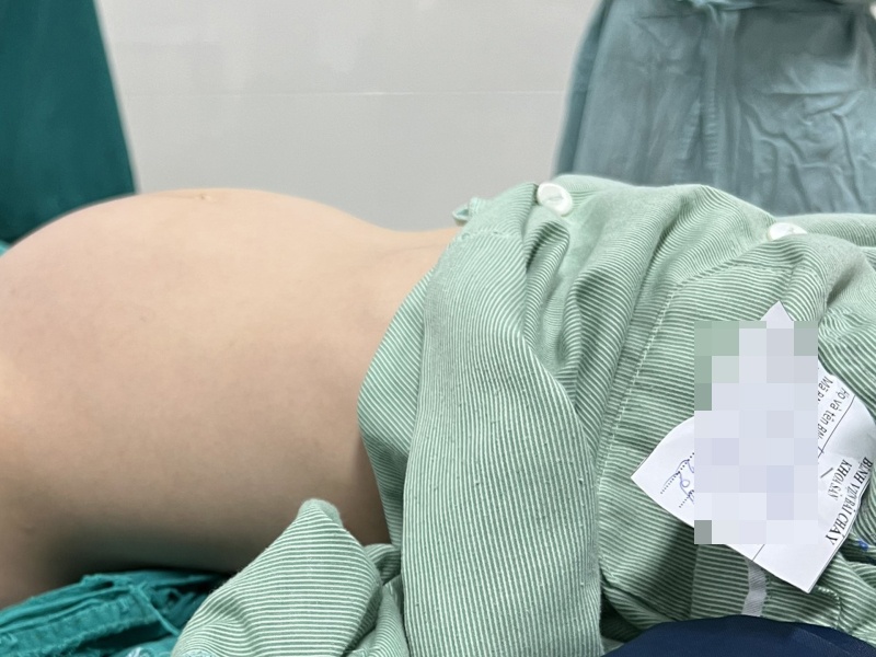 bung to bat thuong anh 1