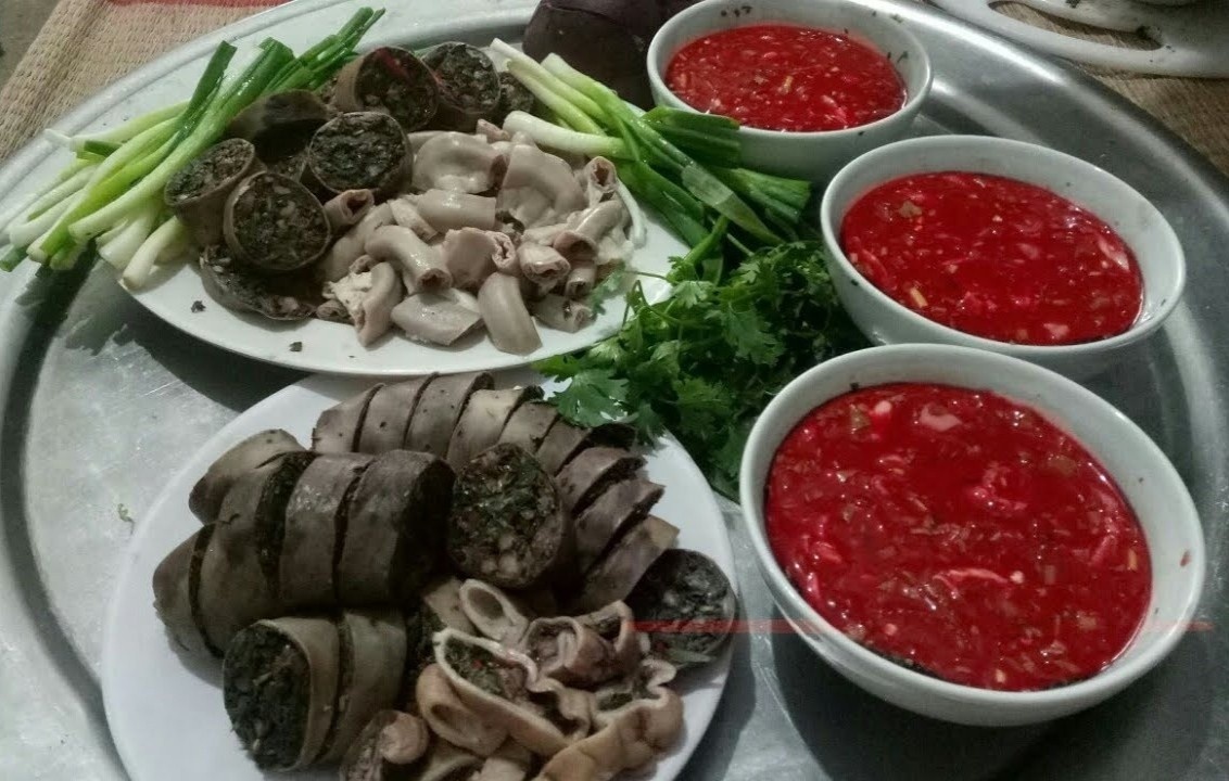 Khoi u chiem 3/4 ruot vi so thich uong ruou, an tiet canh hinh anh