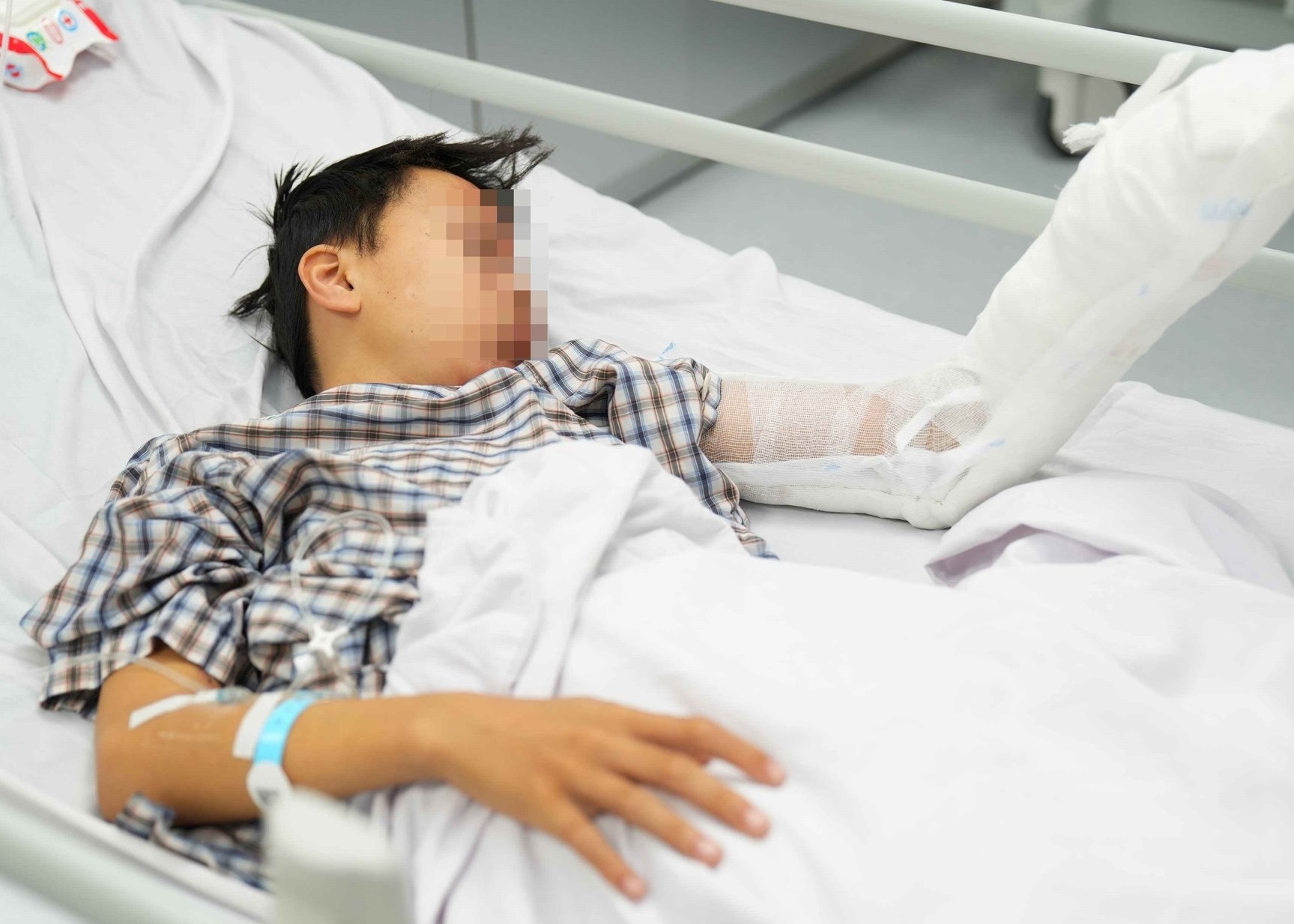 Thieu nien 13 tuoi nat tay, bong mat do binh gas mini phat no hinh anh