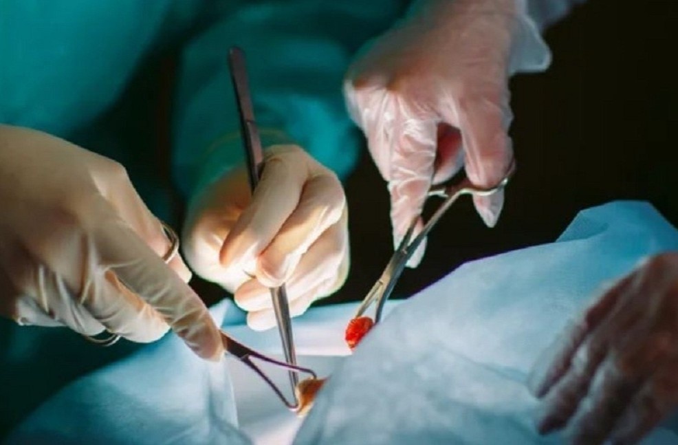 Thuc hu quan niem ung thu khong nen 'dung dao keo’ hinh anh