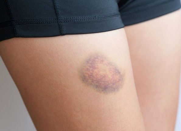 Dau hieu canh bao benh gan ban can biet hinh anh