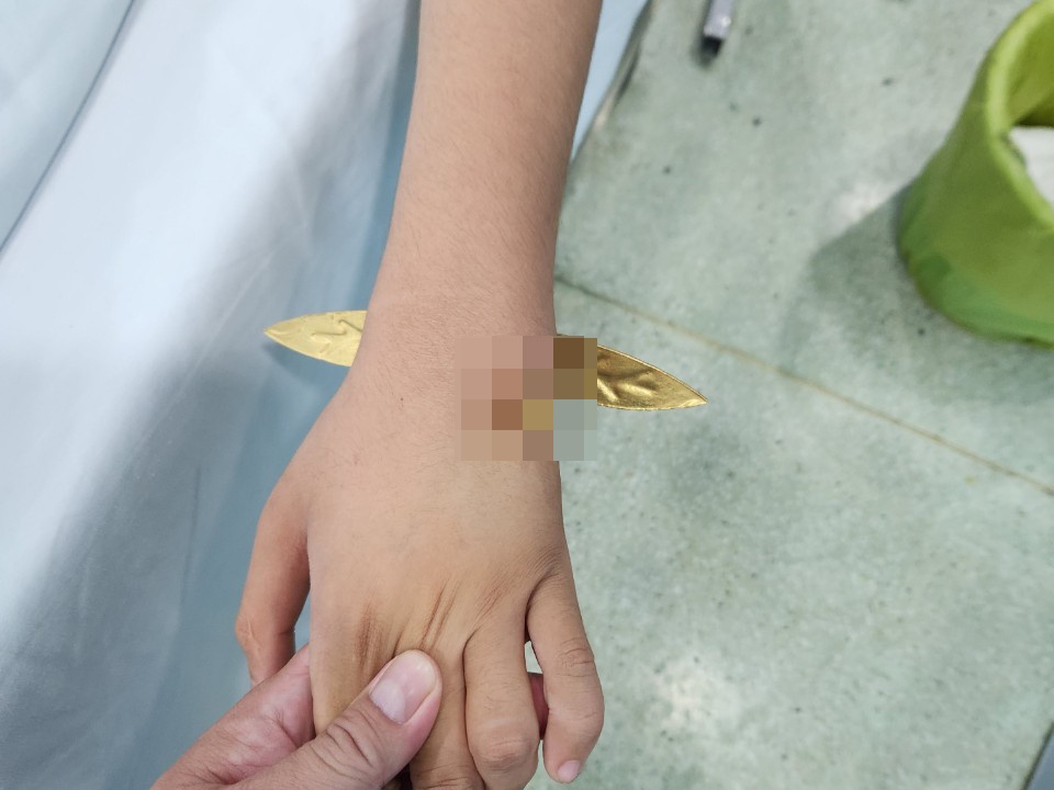 Bi thanh kim loai dam xuyen thau co tay do nga khi di tham mo can Tet hinh anh