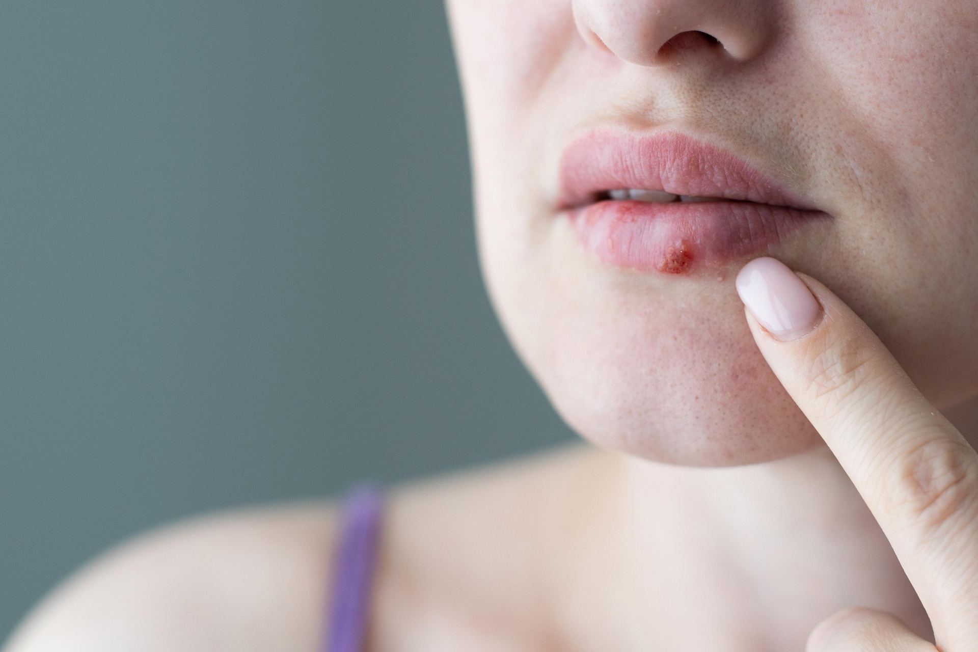 Can benh truyen nhiem khong the chua khoi hoan toan hinh anh