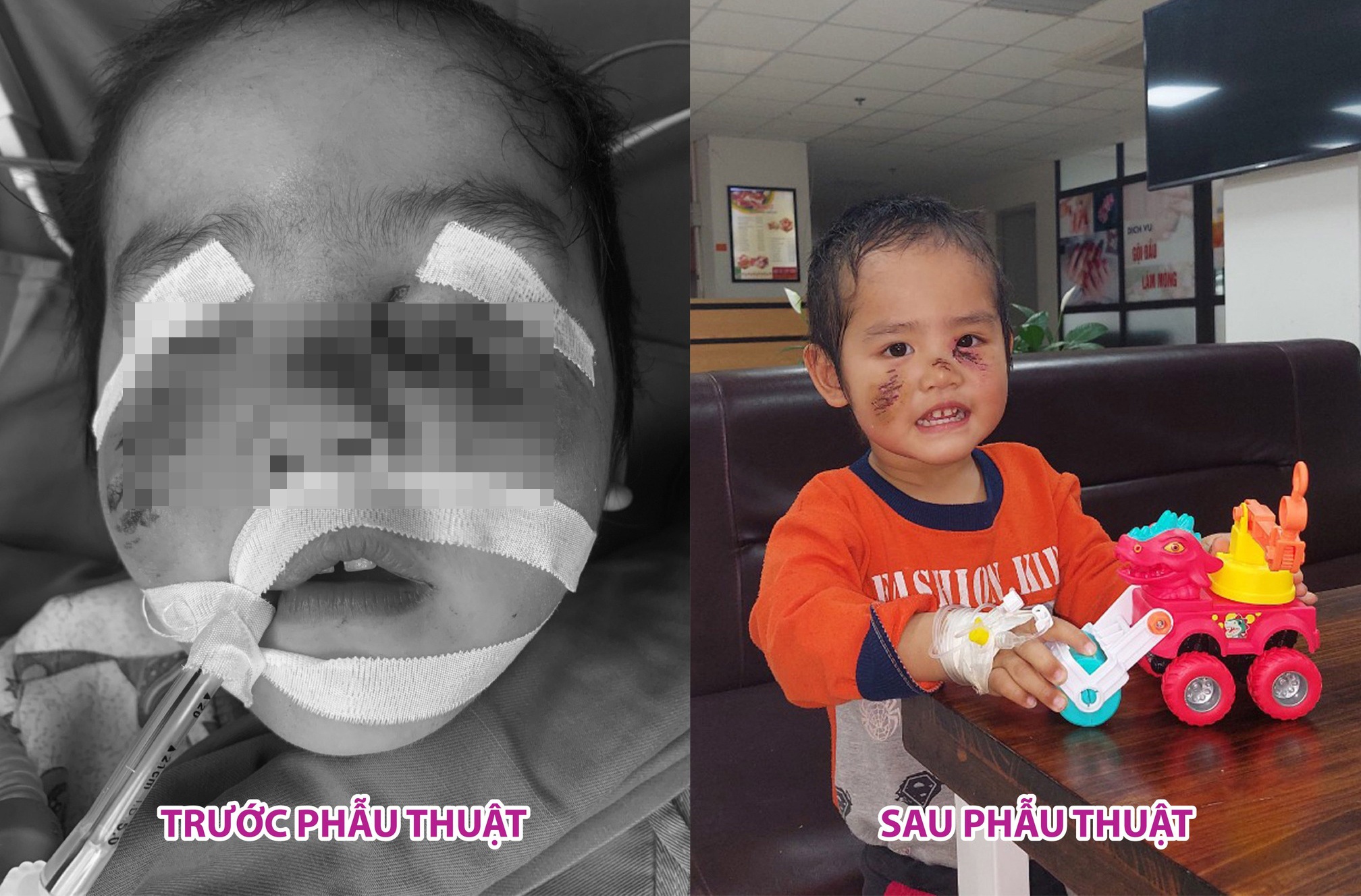 cho nha hang xom can anh 1