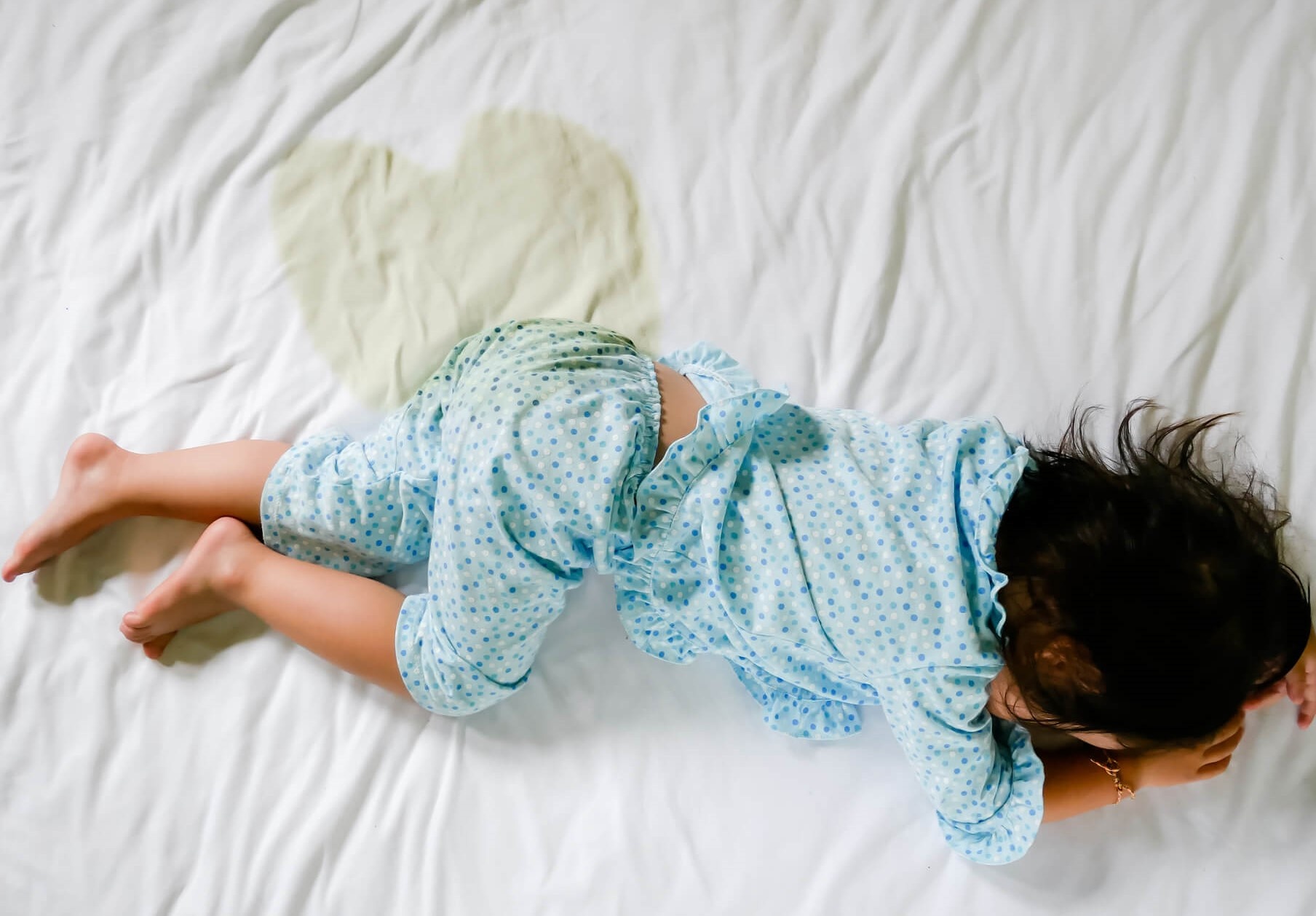 Nhung dau hieu nhiem khuan tiet nieu o tre em khong nen bo qua hinh anh