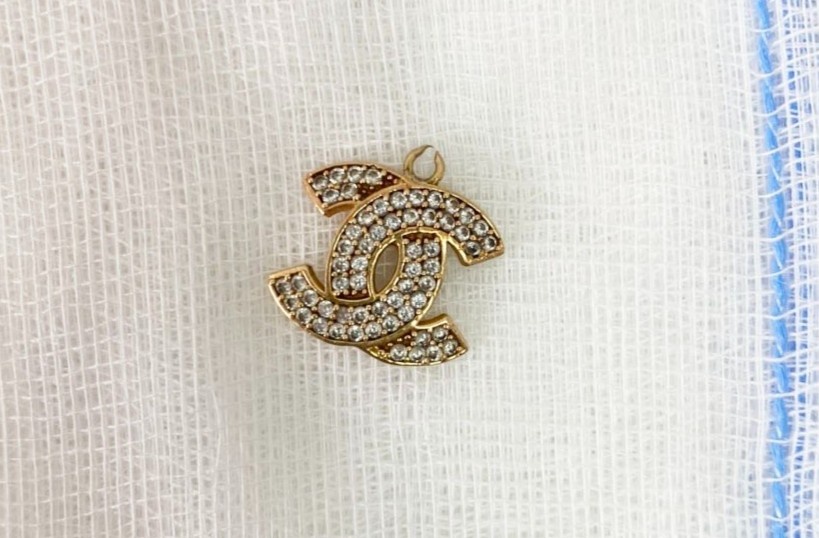 Be 6 thang tuoi suyt mat mang vi nuot mat day chuyen hinh anh